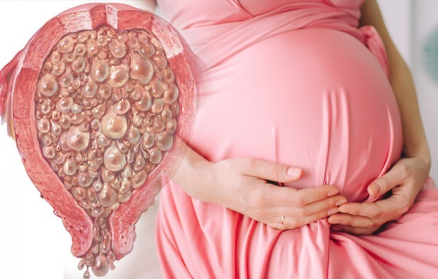 ¿Qué es el embarazo de uva, síntomas del embarazo de uva
