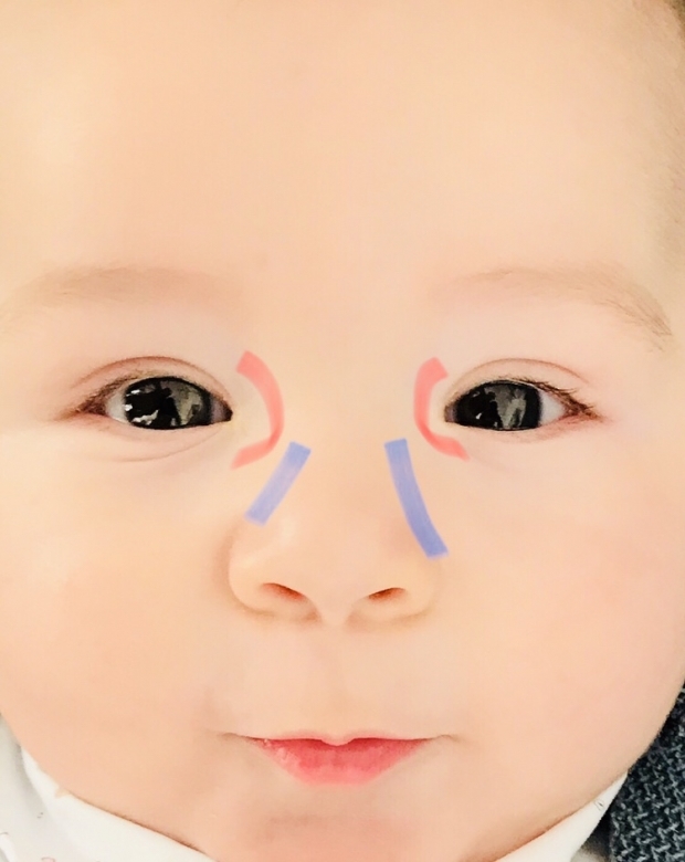 Masaje ocular en bebés