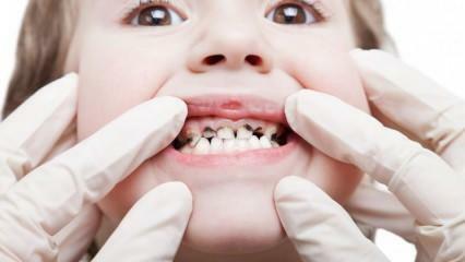 ¡Haga el cuidado dental de su hijo durante el semestre!