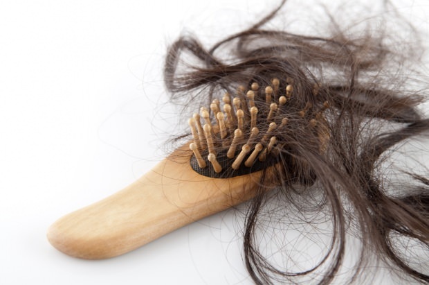 causas de pérdida de cabello