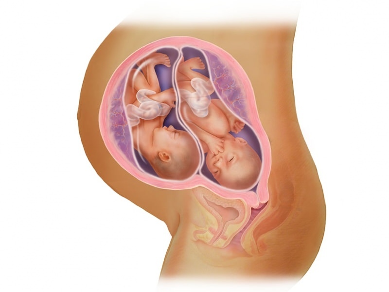 ¡Embarazo gemelo en la FIV! ¿Qué es la transferencia de embriones?