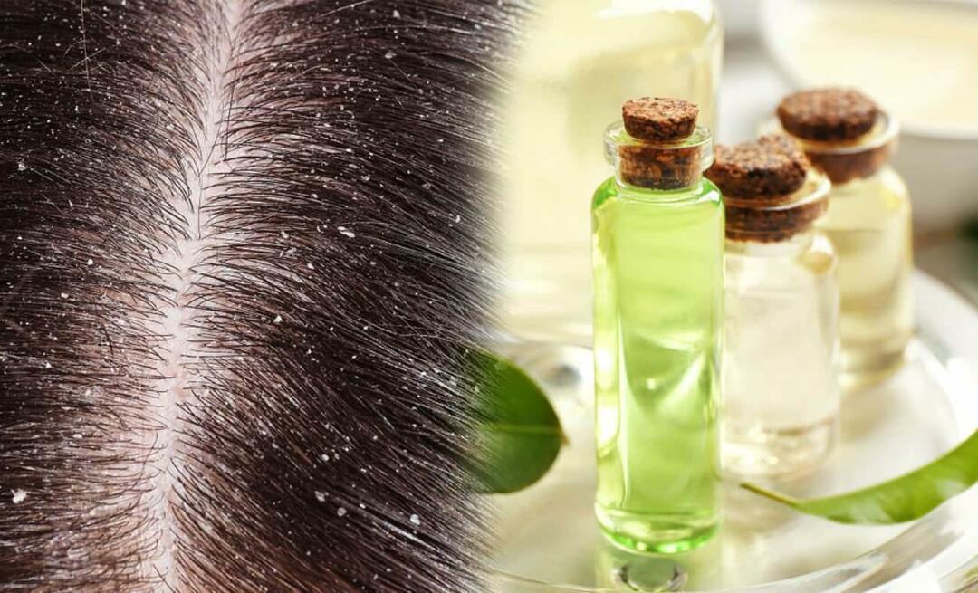 ¿Se puede utilizar aceite de árbol de té para la caspa? ¿Puedes aplicar aceite de árbol de té en tu cabello? ¿Es bueno?