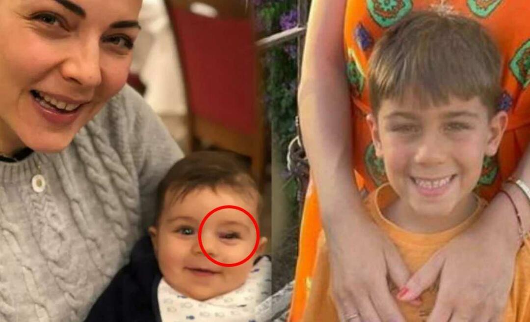 ¡Burcu Kara anunció la enfermedad de su hijo! La hinchazón en el ojo es un signo de un tumor...