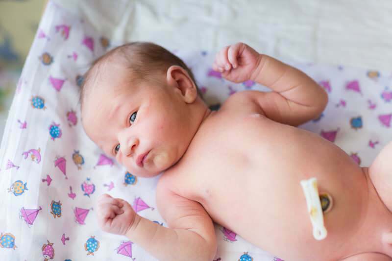 Corte tardío del cordón umbilical en bebés