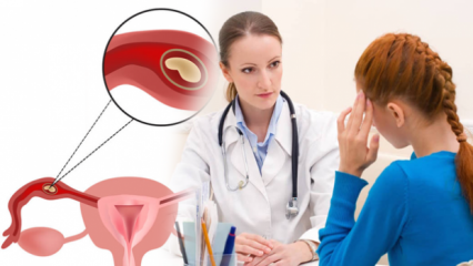¿Qué es el embarazo ectópico (embarazo ectóbico), por qué? ¿Cuáles son los signos del embarazo ectópico?