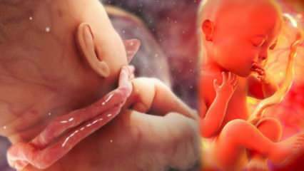 ¿Qué es un enredo de cordón? Enredo del cordón alrededor del cuello del bebé en el útero de la madre