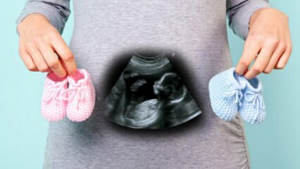 ¿Se determinará el sexo del bebé en el primer trimestre del embarazo?