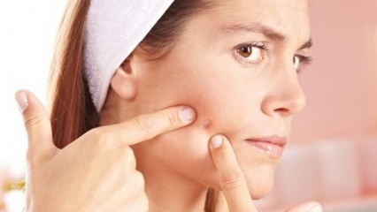 ¿Cuáles son los acné que no deben aburrirse?