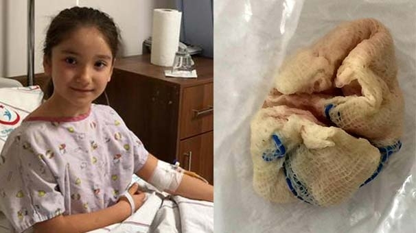 ¡Mira lo que el doctor olvidó en la garganta de la niña!