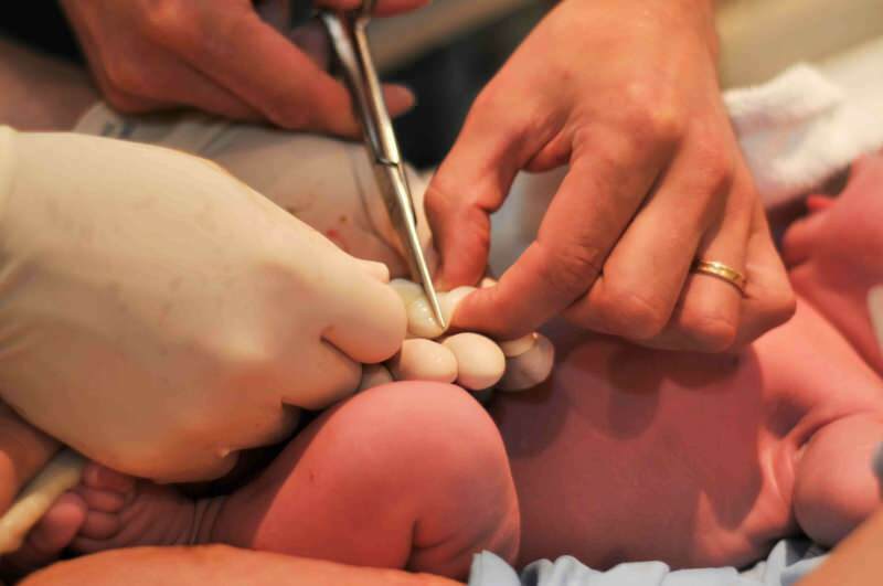 ¿Cuándo se debe cortar el cordón umbilical en los bebés?