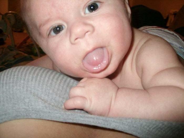 lengua fuera en bebes