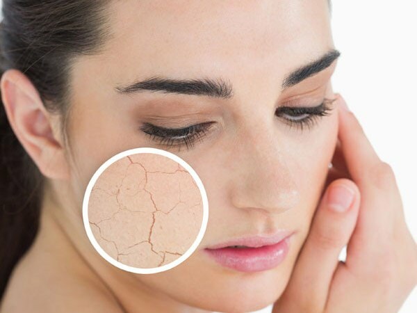 ¿Por qué se seca la piel? ¿Qué hacer en la piel seca? Las recomendaciones de cuidado más efectivas para la piel seca.