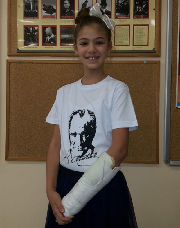 El brazo de Isabella Damla Güven estaba roto pero no salió del set.