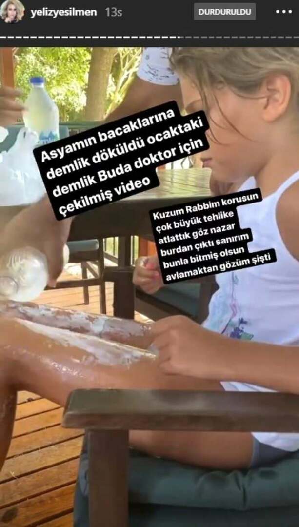 Se vertió agua hirviendo en las piernas de la hija de Yeliz Yeşilmen