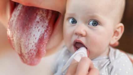 ¡Síntomas y tratamiento del aftas en los bebés! ¿Cómo se transmite la candidiasis en los bebés? La solución exacta ...