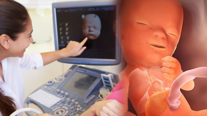 ¿Qué órgano se desarrolla primero en los bebés? Desarrollo del bebé semana a semana