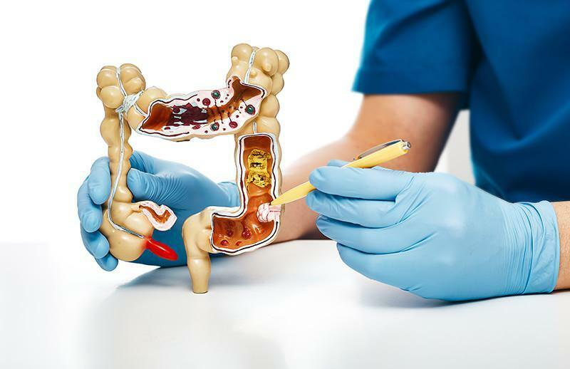tratamiento de la obstrucción intestinal en adultos