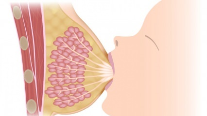 ¿Qué es la mastitis (inflamación de los senos)? Síntomas y tratamiento de la mastitis durante la lactancia