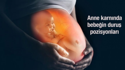 ¡Las posiciones posturales del bebé en el útero de la madre! ¿Cómo entender la posición del bebé? Al canal de parto ...