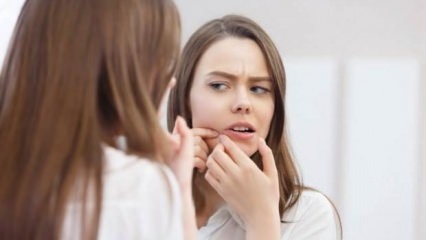 ¿Cuáles son las causas de las espinillas en la cara?