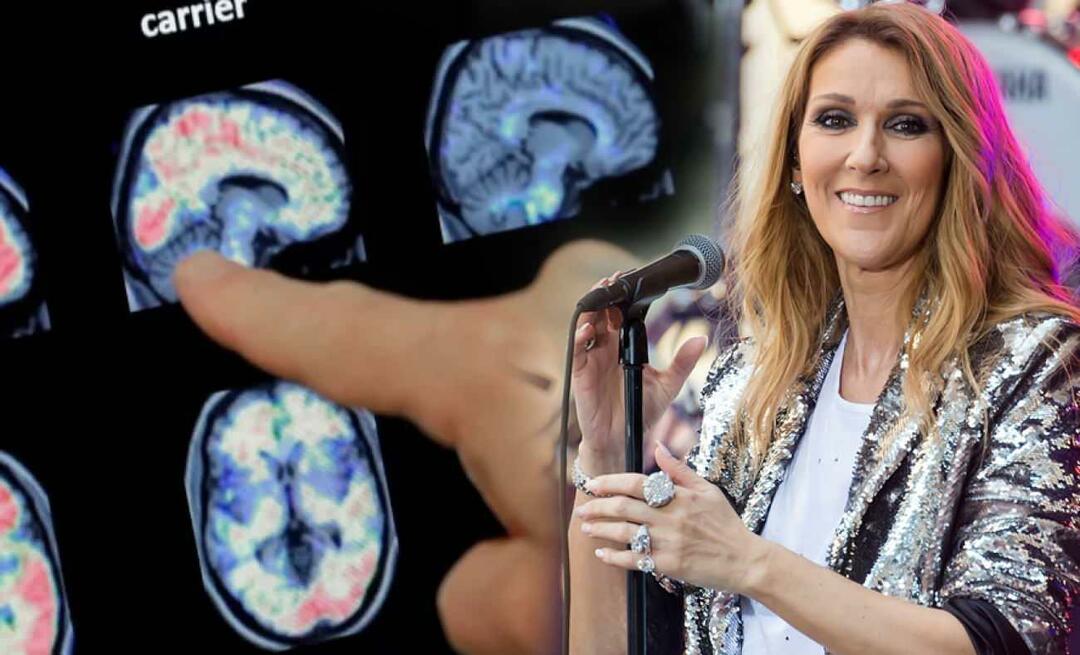 ¿Qué es el síndrome de la persona rígida? ¿Cuál es la enfermedad de Celine Dion?