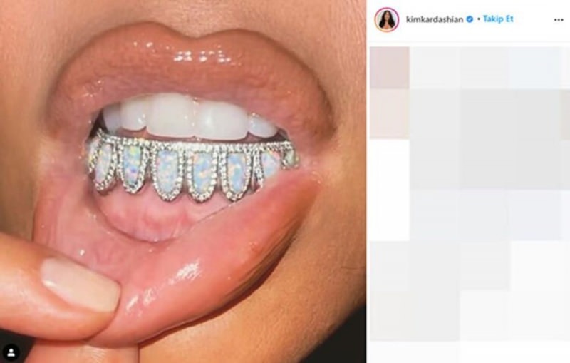 La joya dental de $ 5,000 de Kim Kardashian
