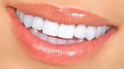 Métodos naturales de blanqueamiento dental
