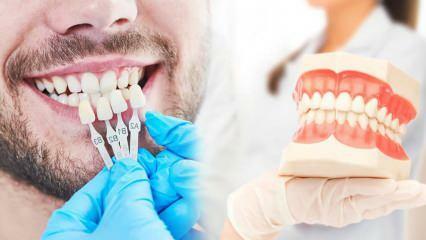 ¿Por qué se aplica una carilla de zirconio a los dientes? ¿Qué tan duradero es el recubrimiento de zirconio?