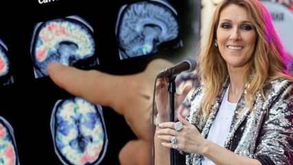 ¿Qué es el síndrome de la persona rígida? Celine Dion