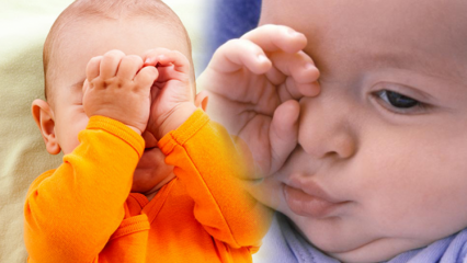 Soluciones naturales para la quemadura ocular en bebés.