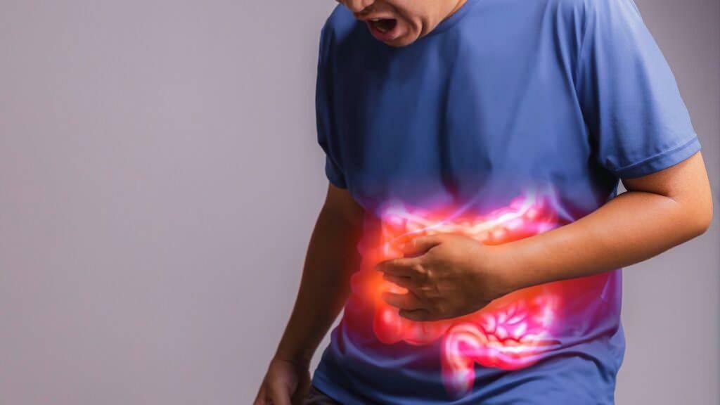 signos de obstrucción intestinal