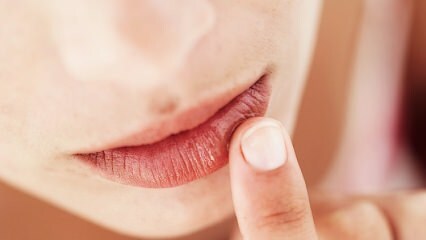 ¿Cómo debe ser el cuidado de los labios durante el embarazo?