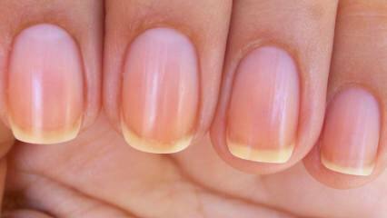 ¿Por qué la uña se pone amarilla? El método más fácil para blanquear las uñas que se vuelven amarillas por el esmalte de uñas