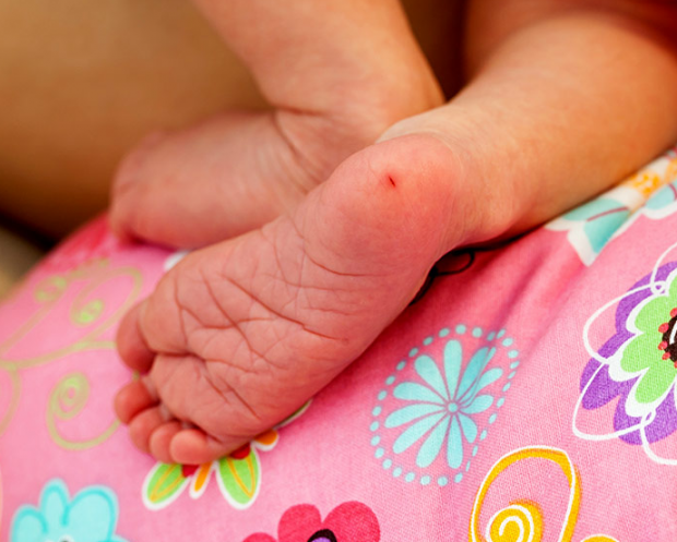 análisis de sangre del talón en bebés