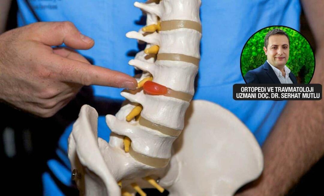 ¿Cómo se diagnostica una hernia de disco y cómo se trata? ¿Se repite la hernia de disco?