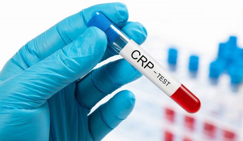 ¿Por qué aumenta la PCR en la sangre? ¿Qué es CRP? ¿Cómo bajar el CRP?