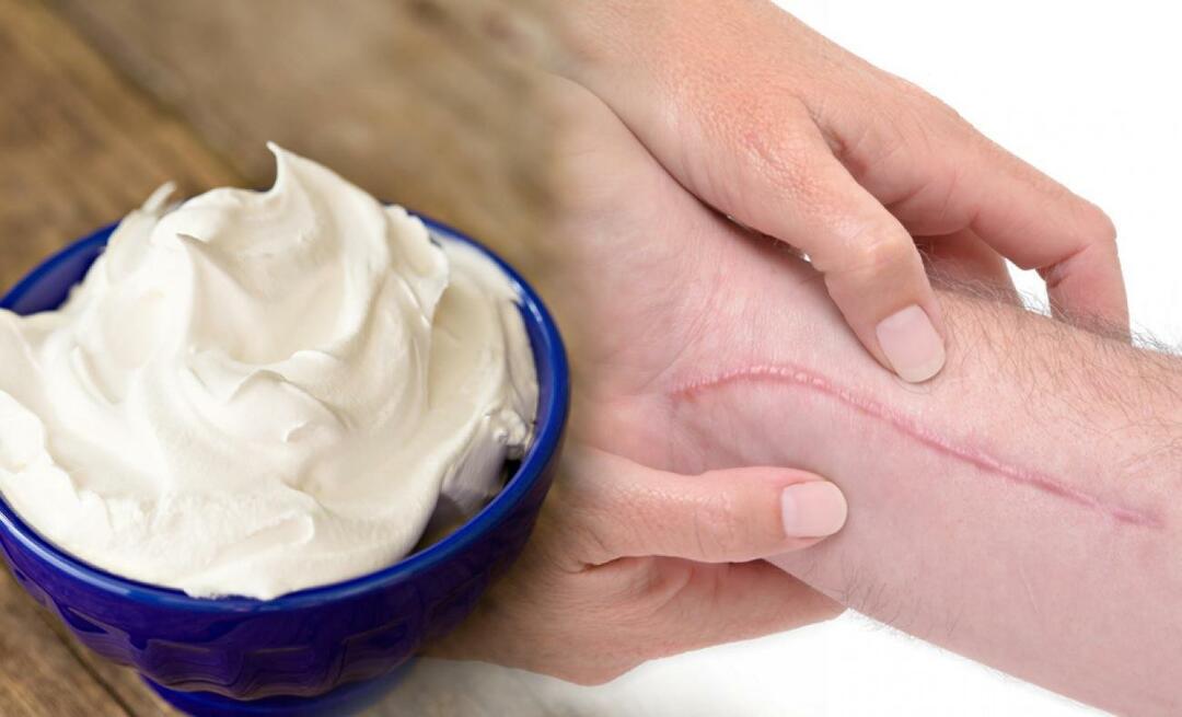 ¡La crema para cicatrices más efectiva! Cuales son las cremas en la farmacia que quitan cicatrices 2023