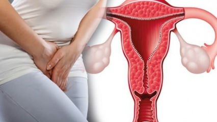 ¿Qué es el engrosamiento de la pared uterina? ¿Cuánto debe ser el grosor de la pared uterina durante el embarazo?