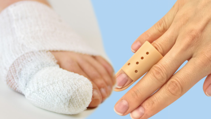 ¿Qué causa la rotura del dedo? ¿Cuáles son los síntomas de rotura de dedo?