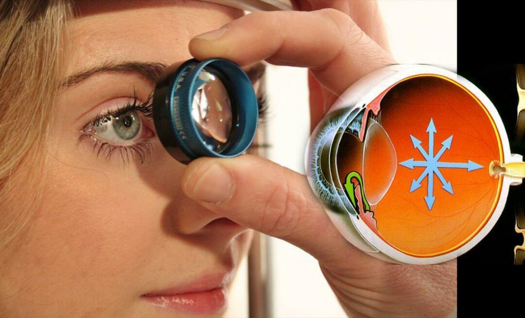 ¿Qué es el glaucoma? ¡Presta atención a esta enfermedad que progresa insidiosamente sin dar ningún síntoma!