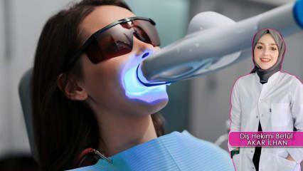 ¿Cómo se hace el método de blanqueamiento dental (Bleaching)? ¿El método de blanqueamiento daña los dientes?