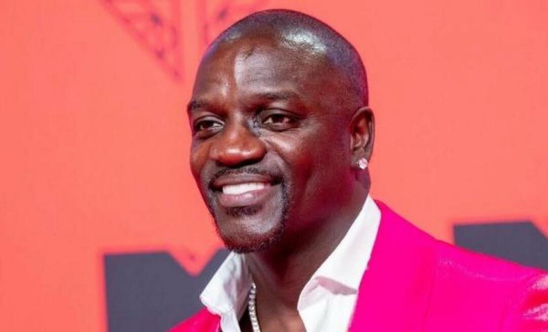 ¡El cantante estadounidense Akon también prefirió Turquía para el trasplante de cabello! Este es el precio que pagó...