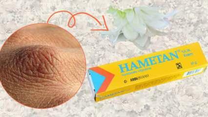 ¿Qué hace la crema Hametan? Hametan crema uso en casa! Diferencias de Hametan