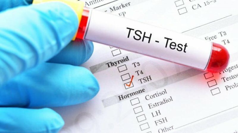 la prueba tsh es una prueba hormonal