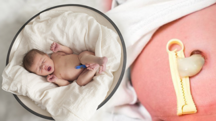 ¿Qué es la placenta previa? ¿Cómo cuidar el cordón umbilical en los bebés? Si el cordón umbilical es largo ...