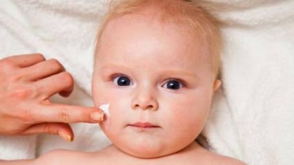 ¡Consejos para el cuidado de la piel para bebés! ¿Cuáles son los problemas de la piel en los bebés?