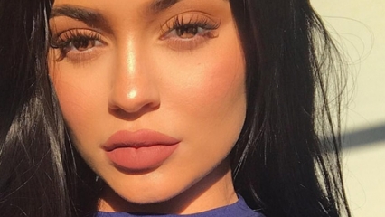 Los labios de Kylie Jenner valen la fortuna