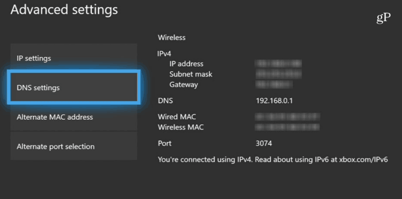 Configuración de DNS de Xbox One