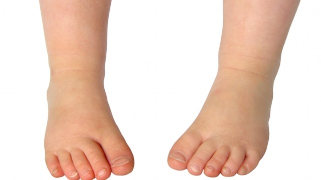 Los 3 problemas más comunes en la salud del pie