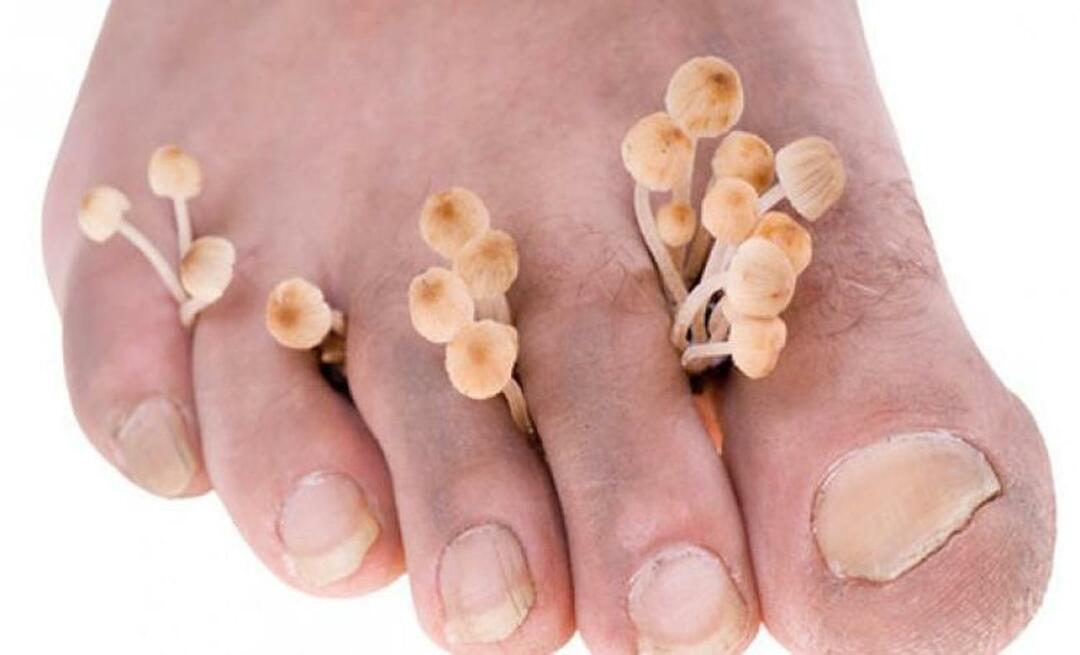 ¿Cómo se transmiten los hongos en los pies?